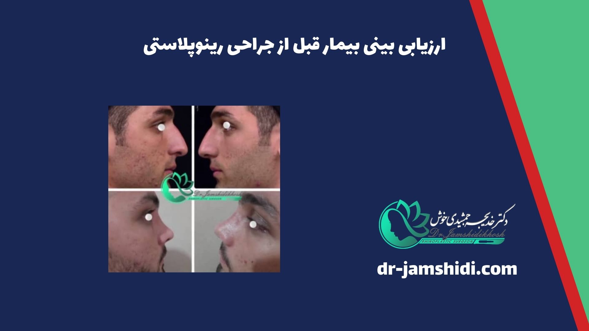 ارزیابی بینی بیمار قبل از جراحی رینوپلاستی