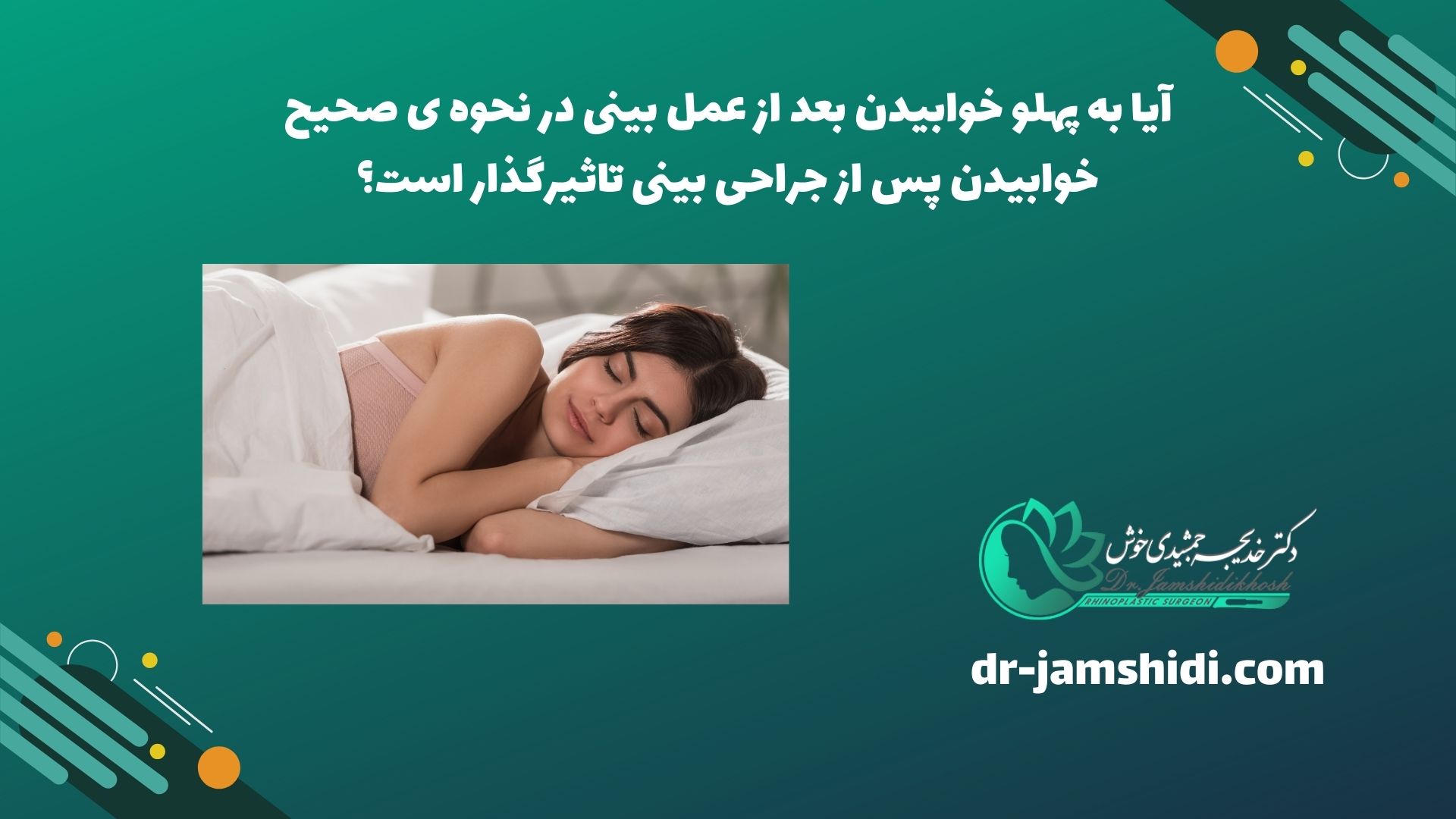 آیا به پهلو خوابیدن بعد از عمل بینی در نحوه ی صحیح خوابیدن پس از جراحی بینی تاثیرگذار است؟