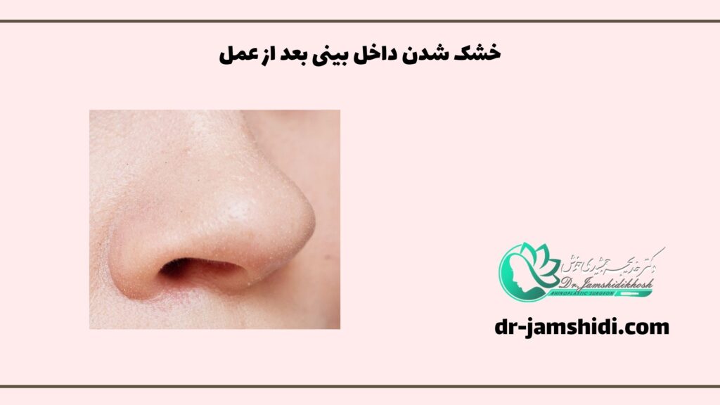 خشک شدن داخل بینی بعد از عمل