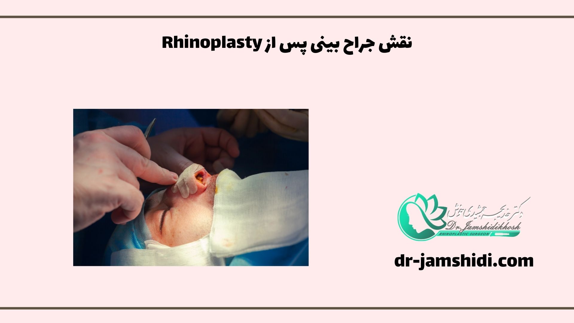 نقش جراح بینی پس از Rhinoplasty