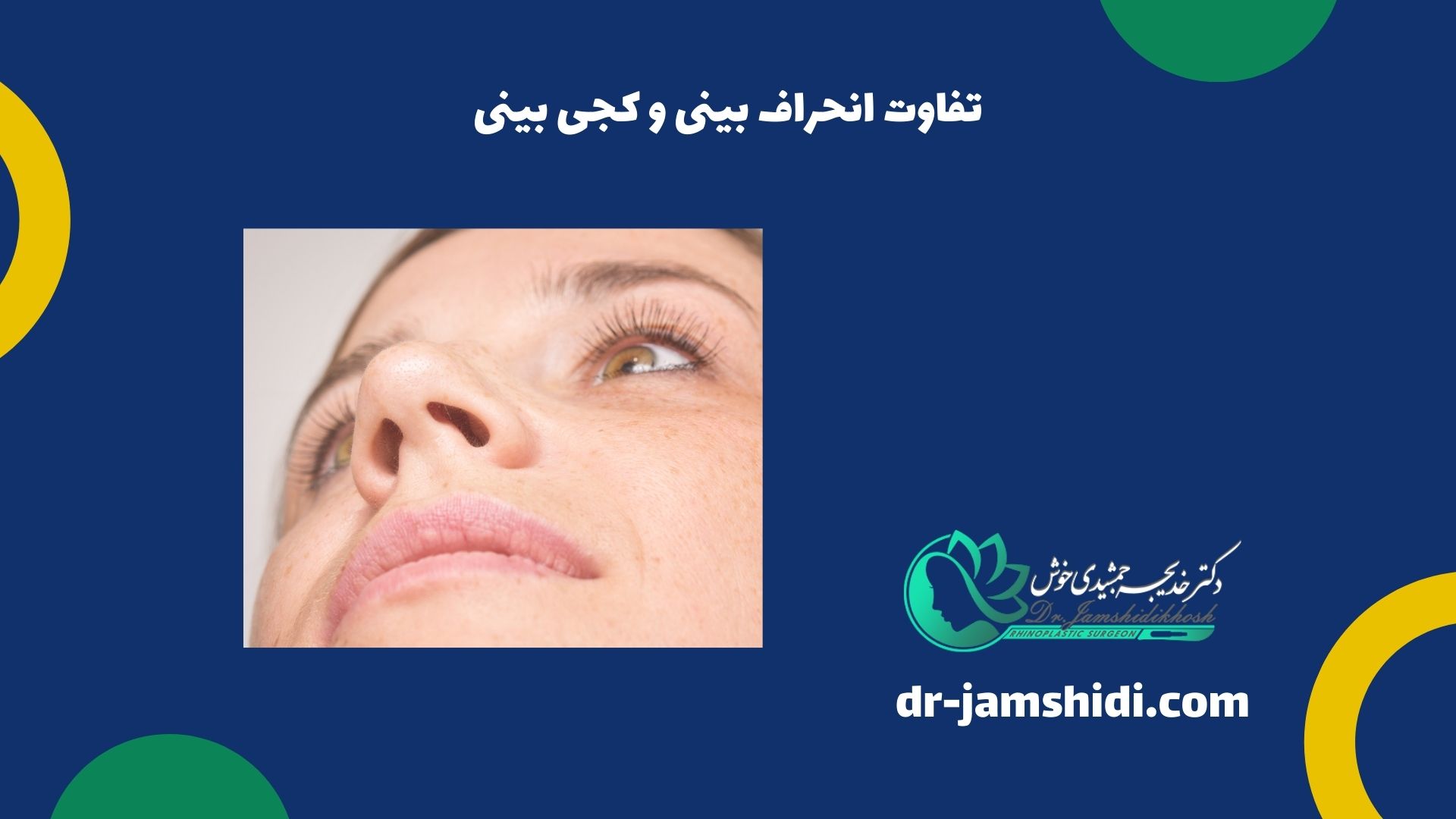 تفاوت انحراف بینی و کجی بینی