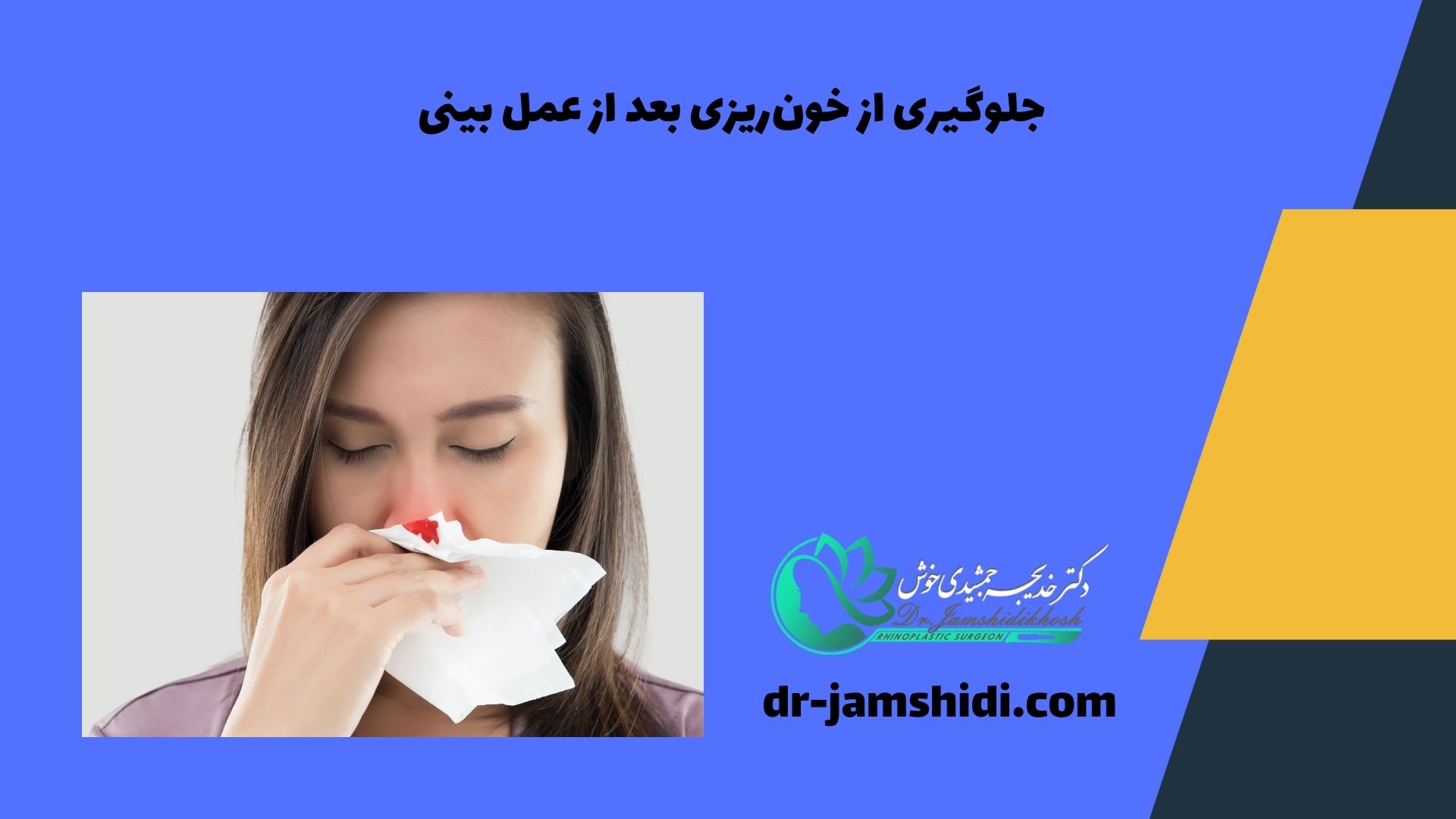 جلوگیری از خون‌ریزی بعد از عمل بینی