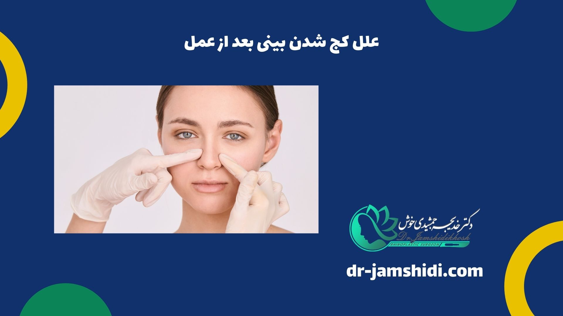 علل کج شدن بینی بعد از عمل