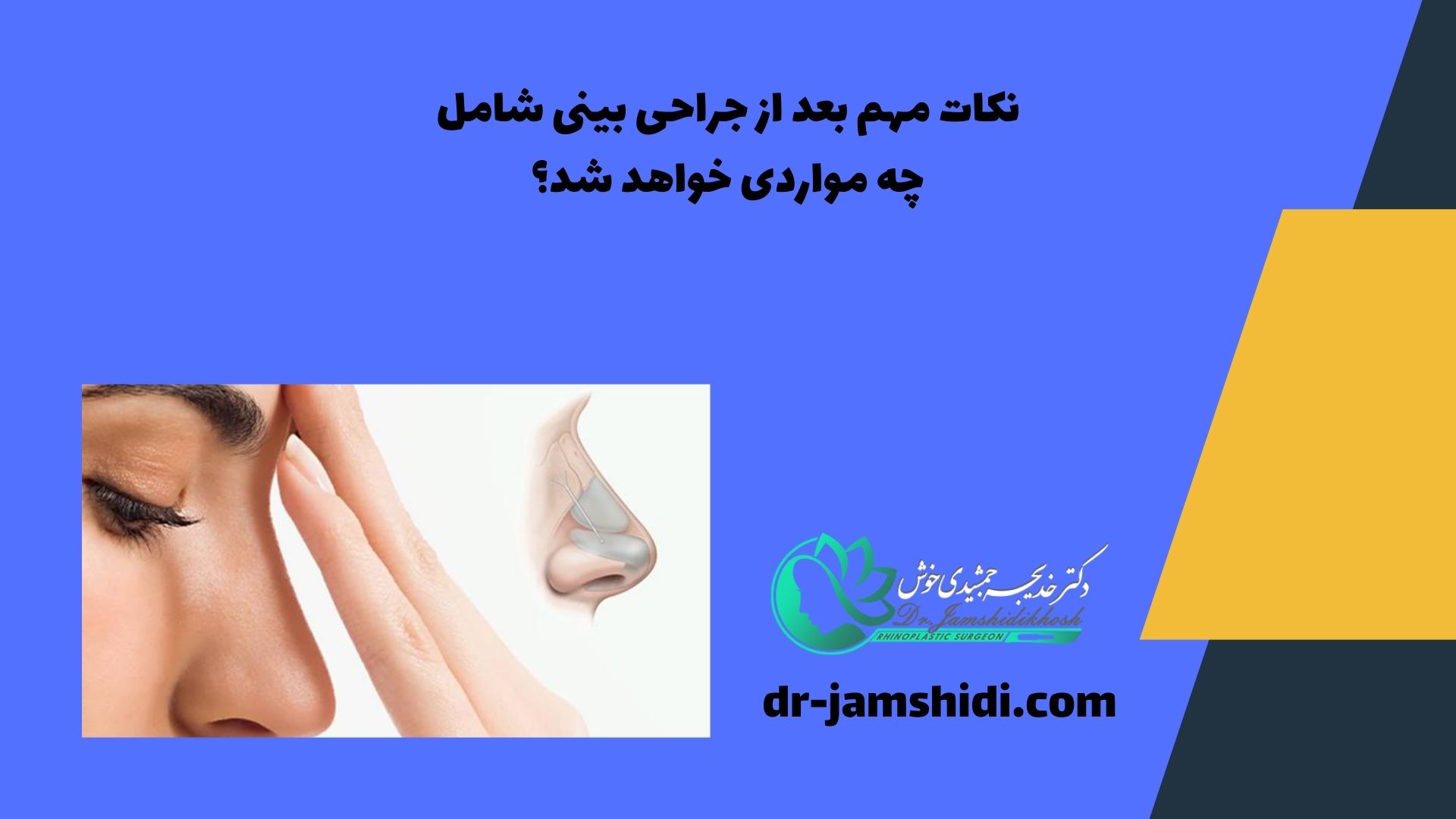 نکات مهم بعد از جراحی بینی شامل چه مواردی خواهد شد؟