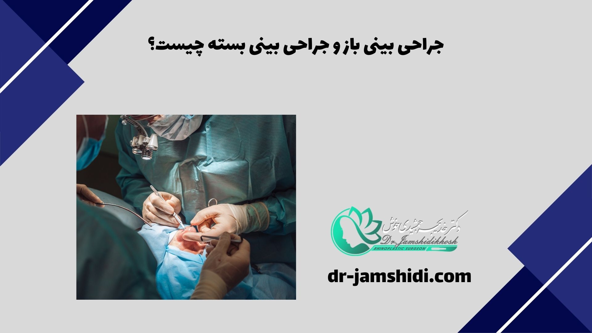 جراحی بینی باز و جراحی بینی بسته چیست؟