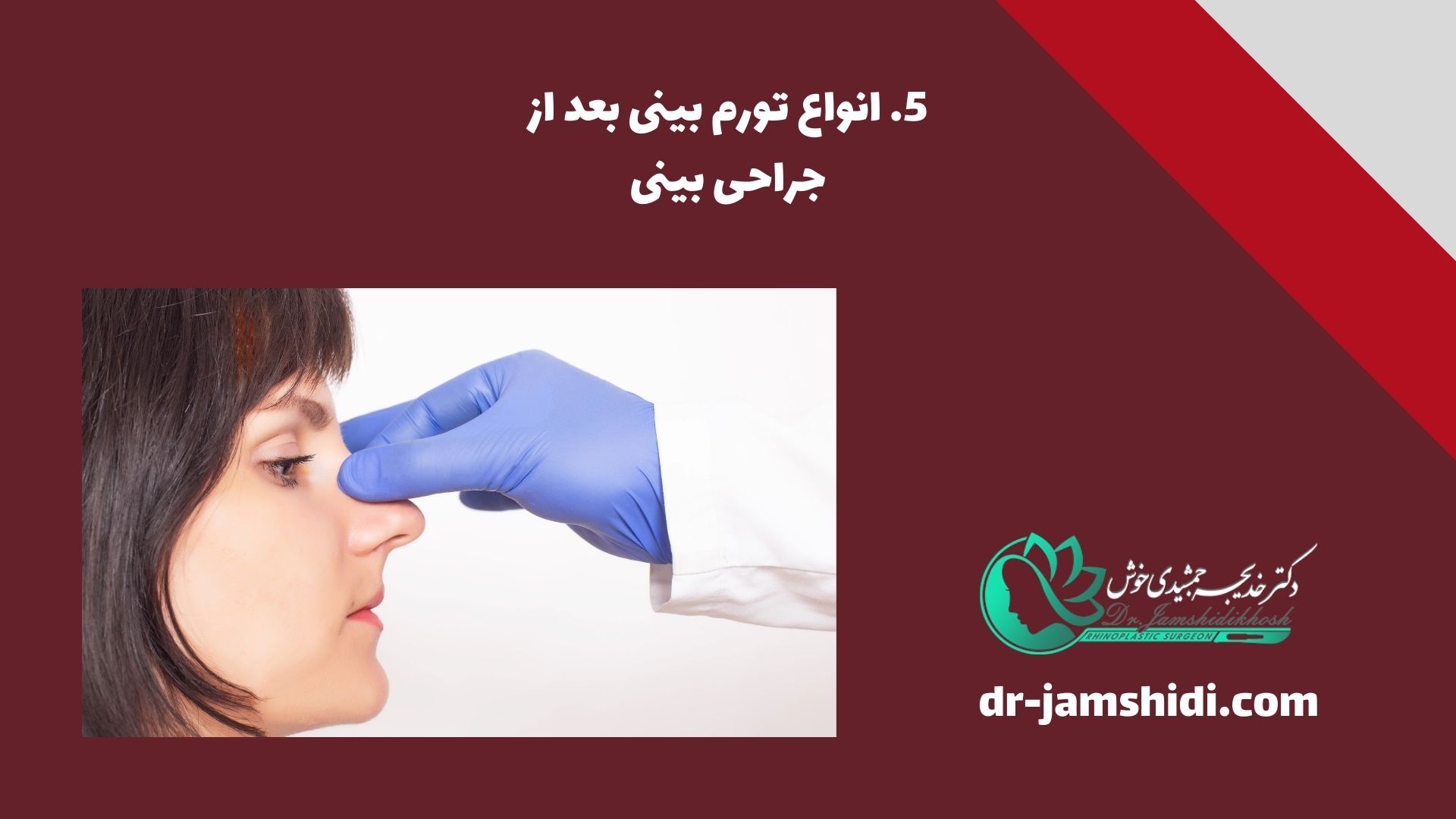انواع تورم بینی بعد از جراحی بینی