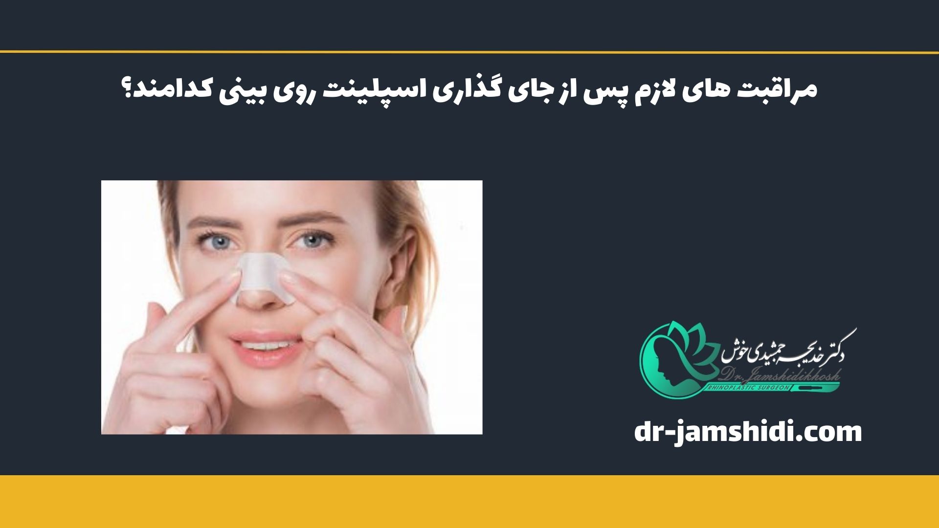 مراقبت های لازم پس از جای گذاری اسپلینت روی بینی کدامند؟