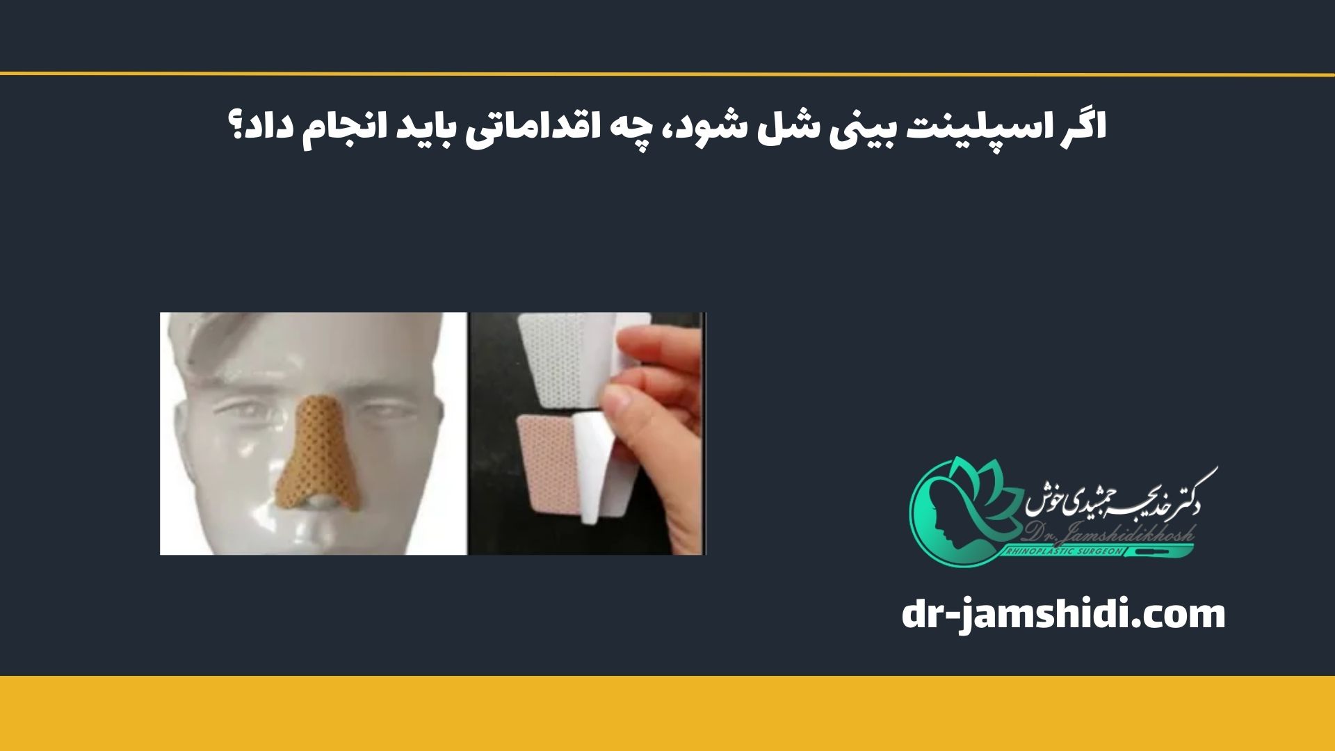 اگر اسپلینت بینی شل شود، چه اقداماتی باید انجام داد؟